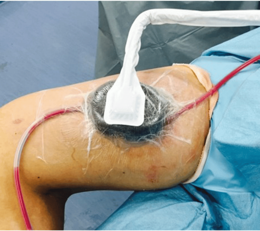 Advanced Treatment Options