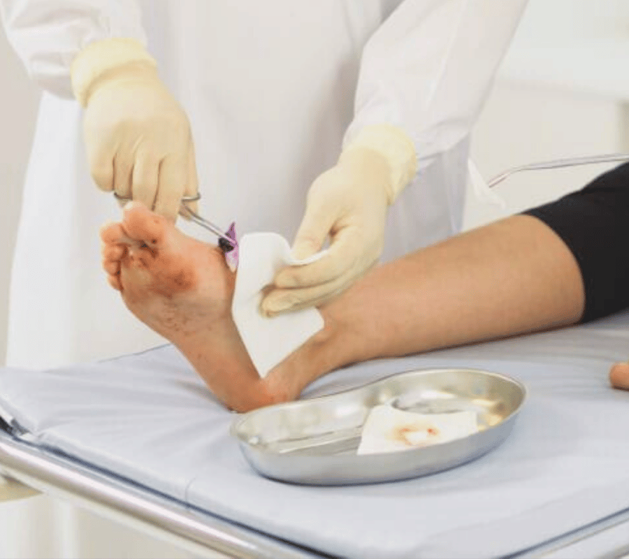 Benefits of Debridement Services