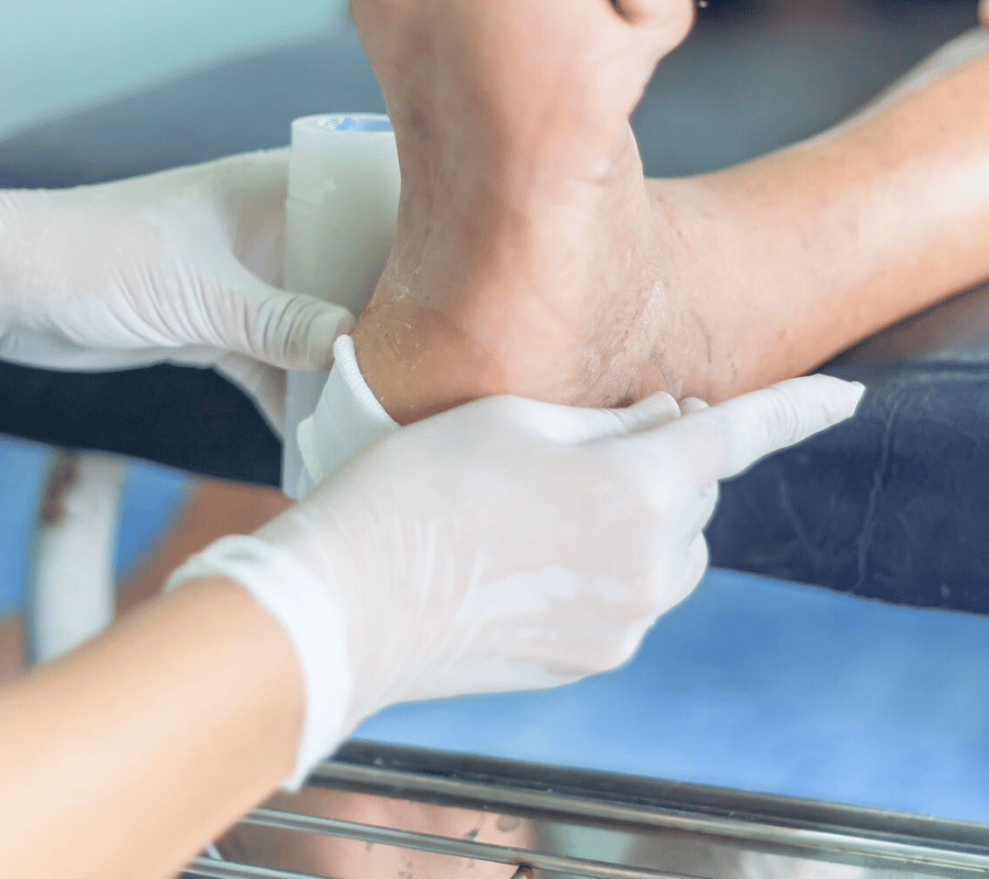 Benefits of Diabetic Foot Ulcer Management Photo