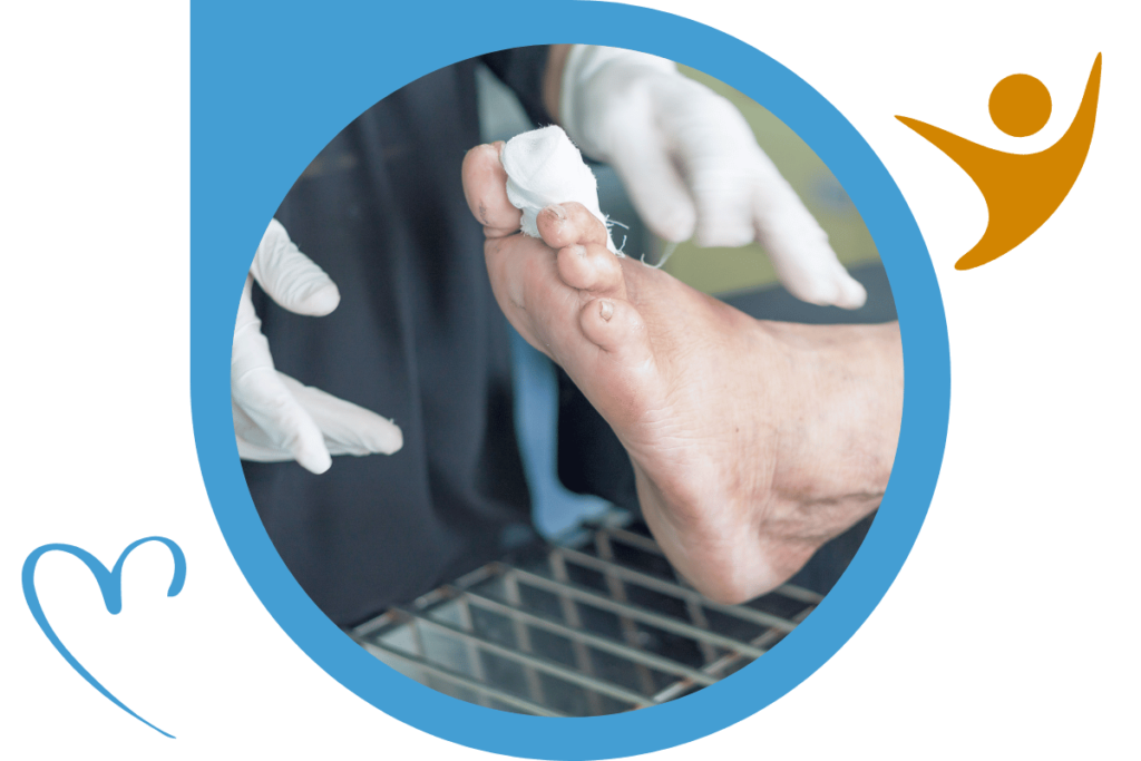 Comprehensive Diabetic Foot Ulcer Management Photo