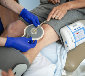 Who Needs Negative Pressure Wound Therapy (NPWT)