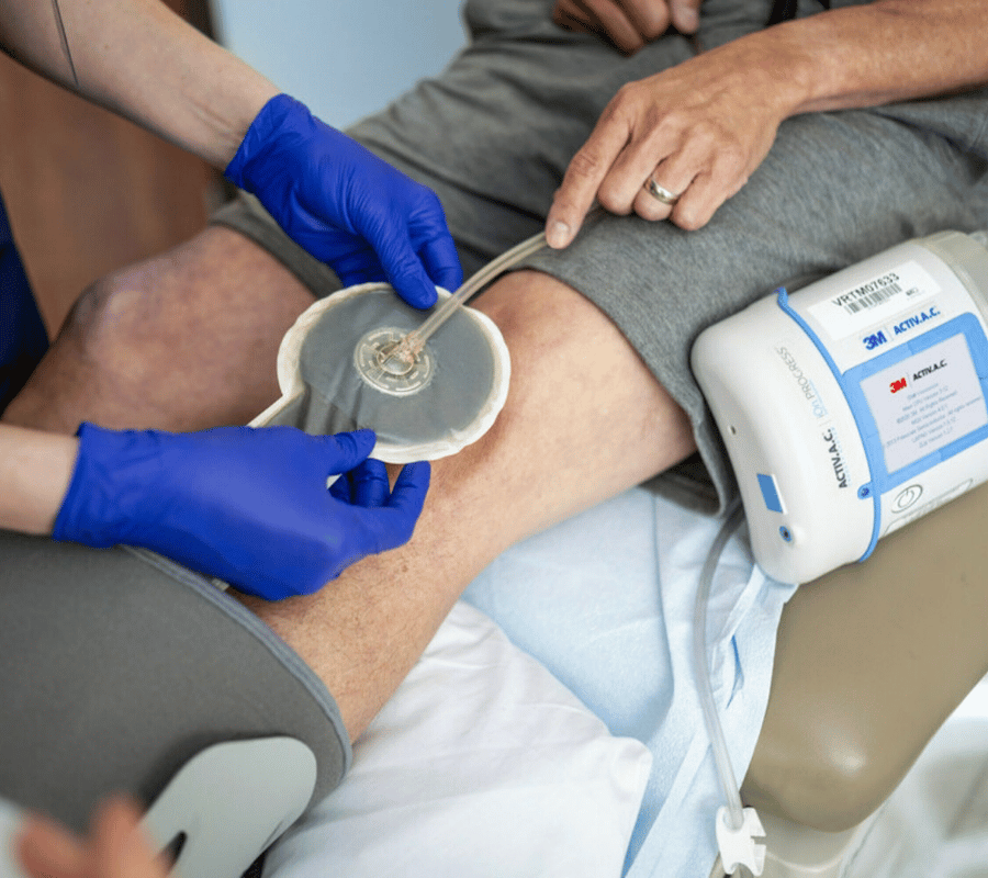 Who Needs Negative Pressure Wound Therapy (NPWT)