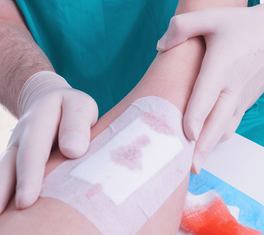 Wound Characteristics Analysis Image