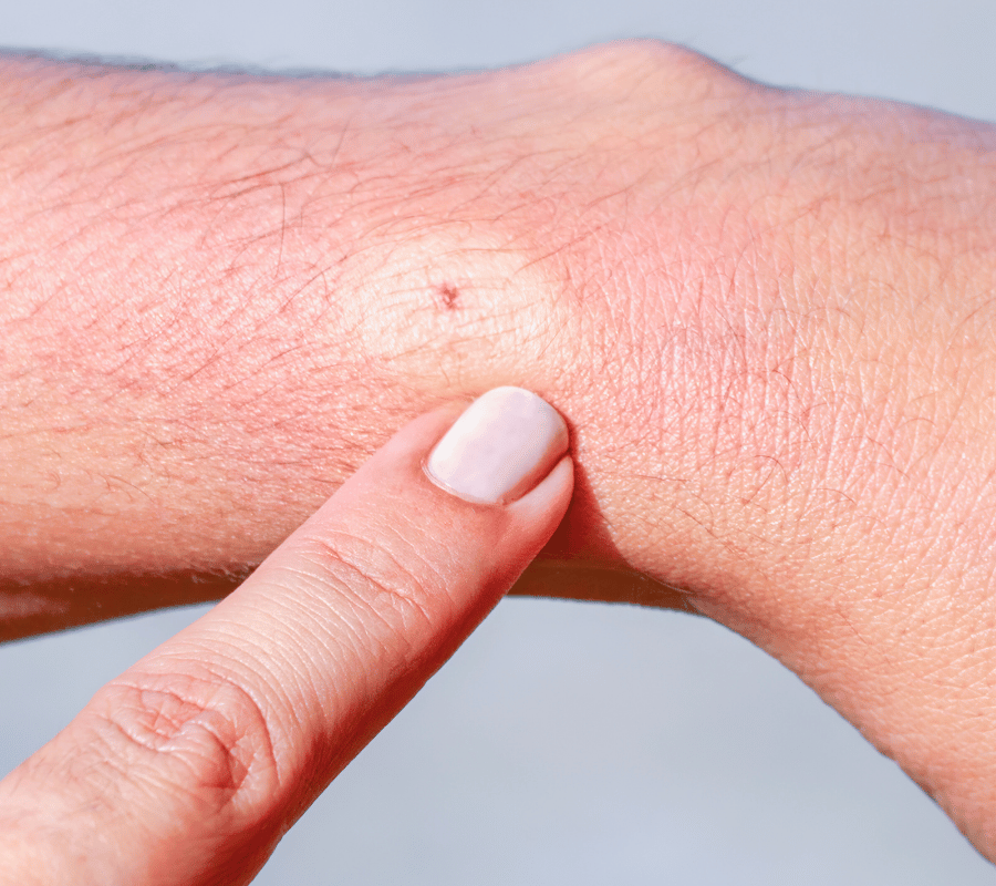 Wound Characteristics Analysis Image