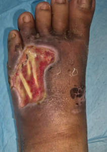 A before photo of the healing process