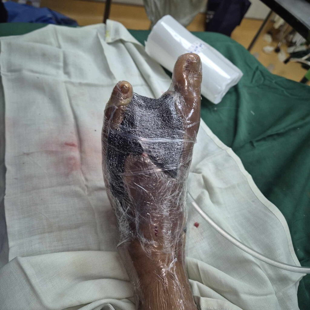Photo of Specialized Dressing