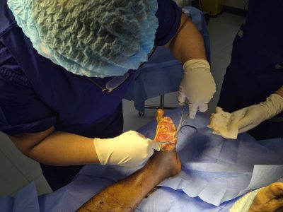Advanced Wound Assessment Photo