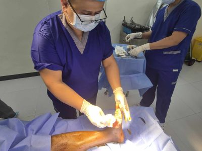 Debridement Services Photo